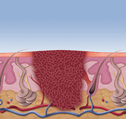 Before treatment