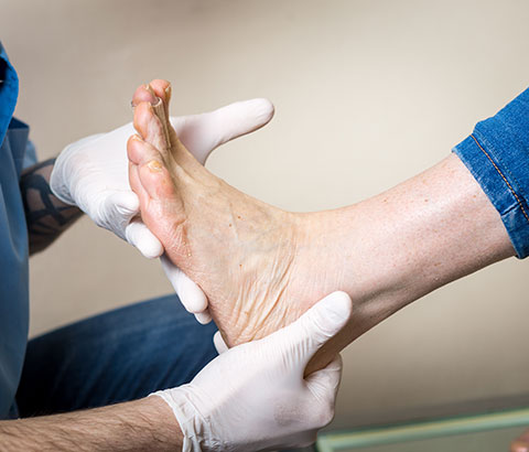 Examine Your Feet
